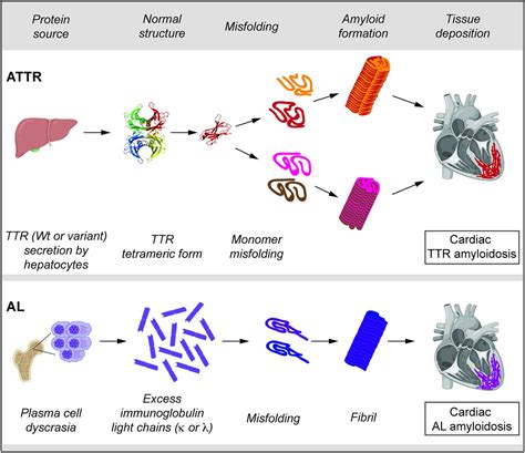 Cardiac Amyloidosis Imaging, Part 1: Amyloidosis Etiology and Image ...