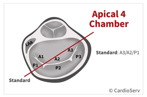 Mitral Valve Orientation in Echo: Anatomy & Scallops Expained!