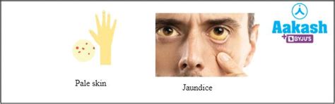 Haemoglobin: Structure, Types, Functions, Common Disorders, Practice ...