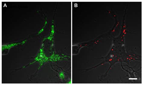 Vimentin Intermediate Filaments Maintain Membrane Potential of ...