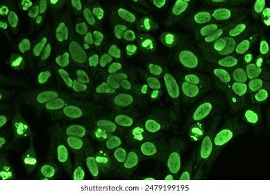 Image result for Ana Pattern Screen