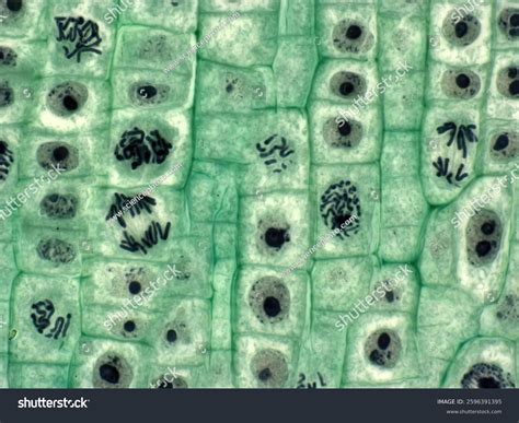 Plant Cell Mitosis Lm Light Microscopy Stock Photo 2596391395 ...