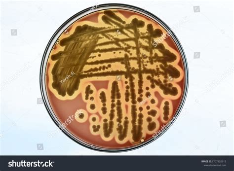 556 Microbe Identification Images, Stock Photos & Vectors | Shutterstock