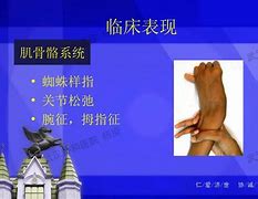 Image result for 综合征