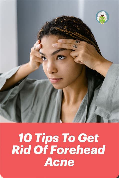 How to Get Rid of Forehead Acne - 10 Tips You Can Try | Forehead acne, Acne treatment, Acne
