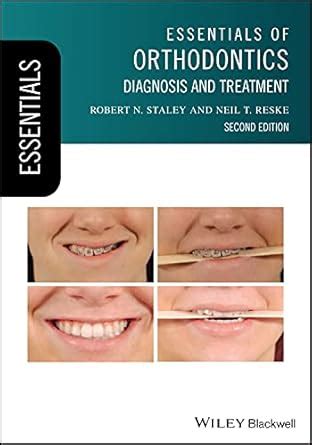Buy Essentials of Orthodontics: Diagnosis and Treatment (Essentials ...