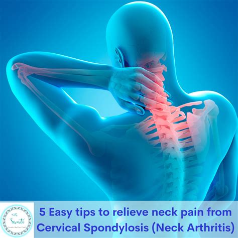 5 Easy tips to relieve neck pain from Cervical Spondylosis (Neck ...