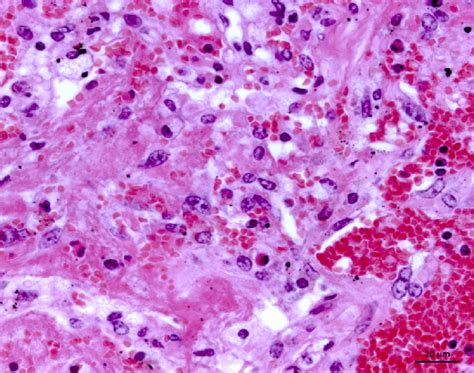 Image result for Hemangiosarcoma