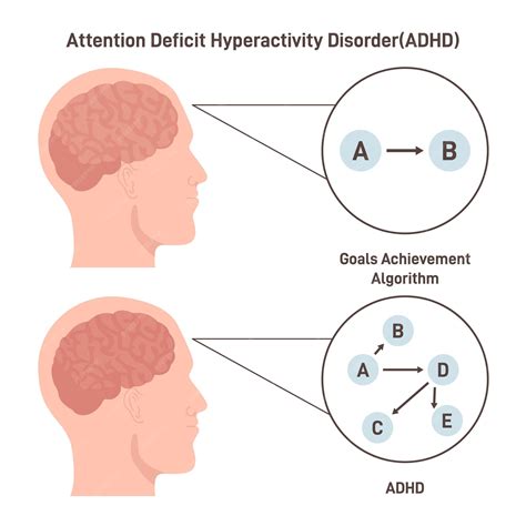 Premium Vector | Adhd brain concept attention deficit hyperactivity disorder way