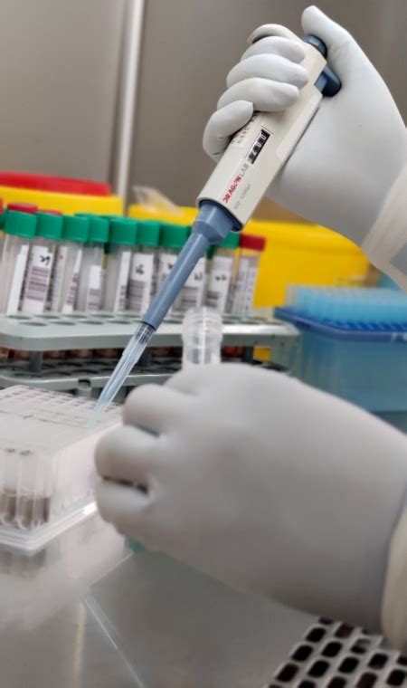 核酸检测知多少？ - 公司动态 - 山东富优生命科学有限公司