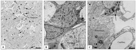 Thymus-Pineal Gland Axis: Revisiting Its Role in Human Life and Ageing