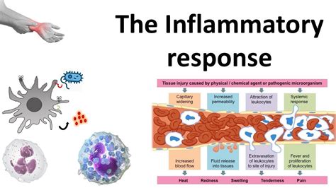 Inflammation Process Steps 的图像结果
