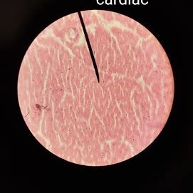 cardiac muscle tissue Diagram | Quizlet