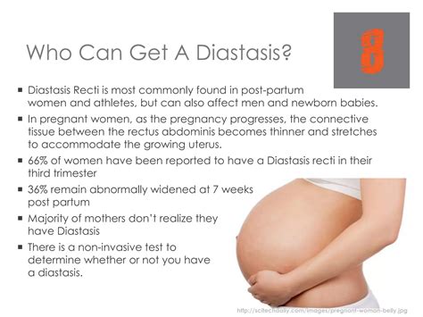 Diastasis - Prevention and Correction | PPTX