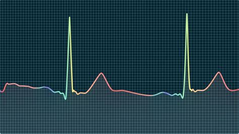 What PR, QRS, and QTc Intervals Mean on Your Watch ECG | Qaly