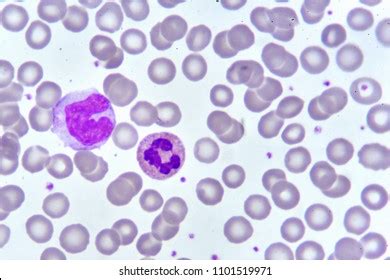 Image result for Monocyte Under Microscope