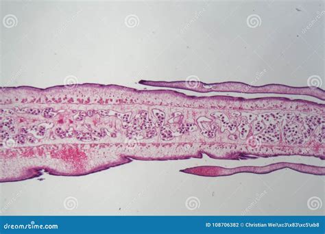 Segment of a Tapeworm Body Proglottid Stock Photo - Image of infection ...