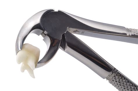 Tooth Extraction Equipment 的图像结果