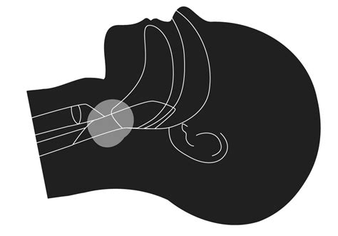 Image result for Obstructive Sleep Apnea