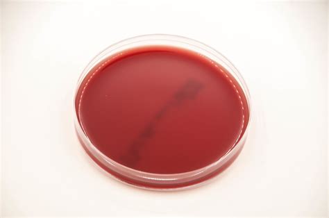 Brucella Blood Agar, Bacteroides Bile Esculin Agar/Phenylethyl Alcohol ...