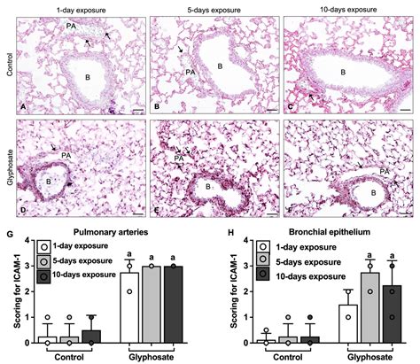 Adhesion Molecules in Lung Inflammation from Repeated Glyphosate Exposures