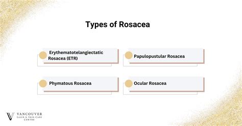 How to Treat Rosacea? (5 Common Symptoms) - Vancouver Laser & Skin Care Centre
