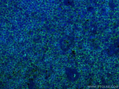 CD45 antibody (60287-1-Ig) | Proteintech