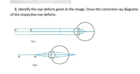 8. Identify the eye defects given in the image. Draw the corrective ray ...