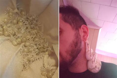 Man With Arachnophobia Decides to Hatch 150 Tarantula Babies ...
