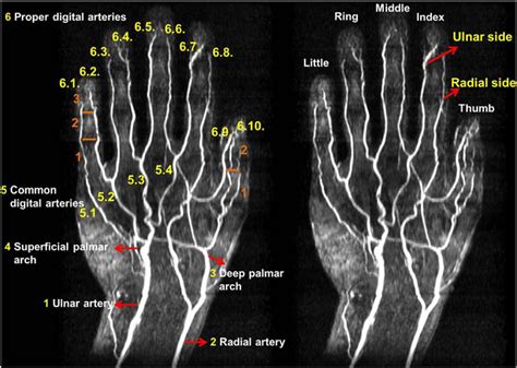 High-resolution, non-contrast-enhanced magnetic resonance angiography ...