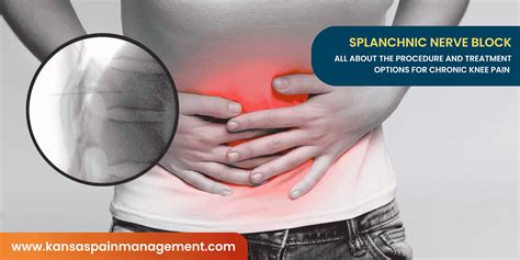 Splanchnic Nerve Block | Chronic Abdominal Pain Relief | KPM