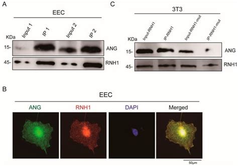 Ribonuclease Inhibitor 1 (RNH1) Regulates Sperm tsRNA Generation for ...