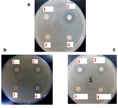 Image result for Agar Plug Diffusion Method