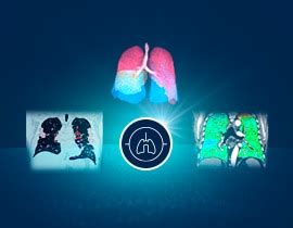 Thoracic VCAR | GE HealthCare (India)