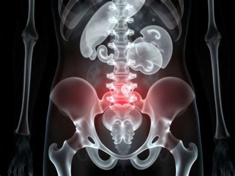 Image result for Psoas Sign Appendicitis