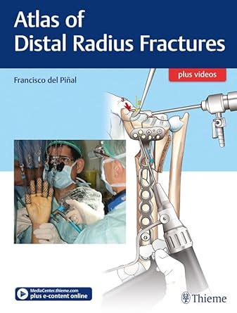 Atlas of Distal Radius Fractures eBook : Del Pinal, Francisco: Amazon ...