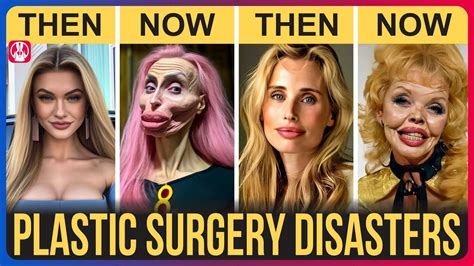 Plastic Surgery Disasters 的图像结果