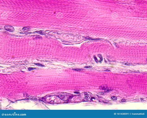 Image result for Skeletal Muscle Tissue Under Microscope
