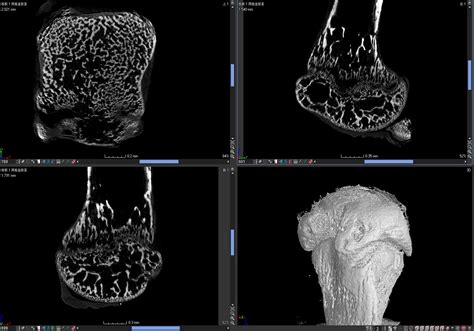 3D-CT和X射线有什么不同，它们作用是什么？-非常爱美