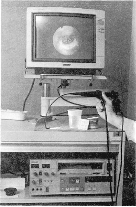 Image result for Modified Barium Swallow Study Basic