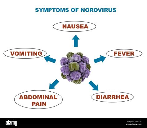 Medical diagram showing symptoms of the norovirus Stock Photo - Alamy