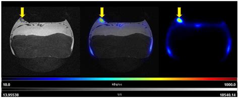 CAM-Xenograft Model Provides Preclinical Evidence for the Applicability ...