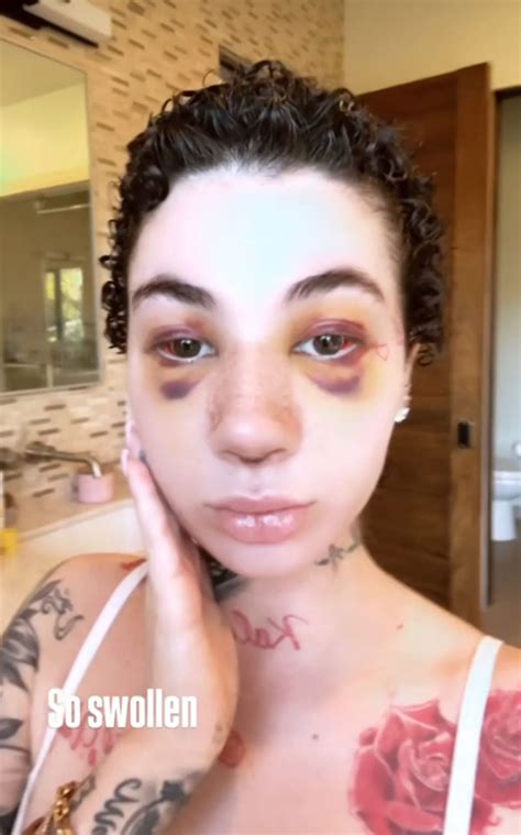 Bhad Bhabie Reveals She Got Nose Job And Clarifies Cancer Diagnosis ...