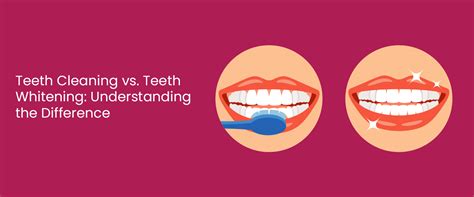 Teeth Cleaning vs Teeth Whitening: Key Differences & Benefits