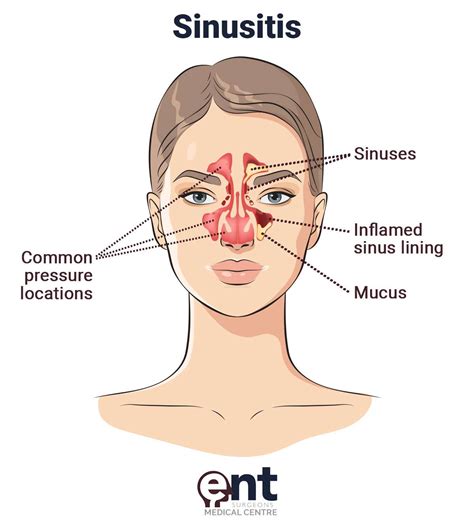 Rezultat imagine pentru ENT Problems