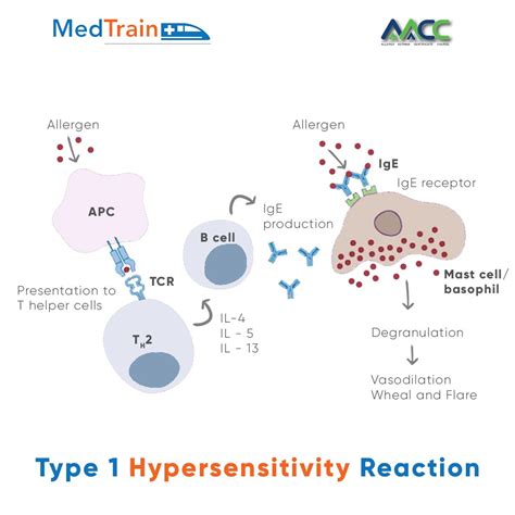 Type 1 Hypersensitivity Reaction in 2025 | Hypersensitivity reactions, Hypersensitivity, Medical ...