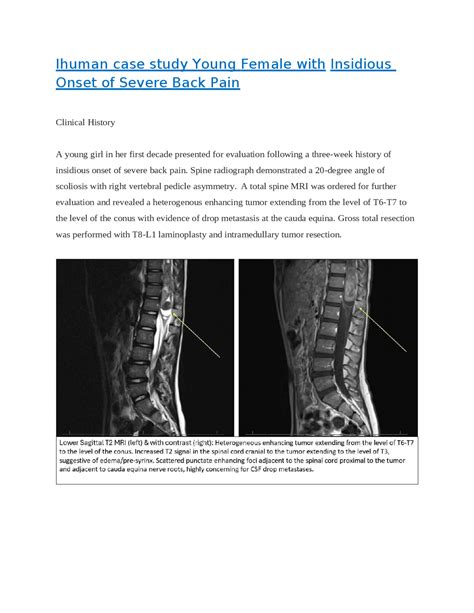 Ihuman case study: Young Female with Insidious Onset of Severe Back ...