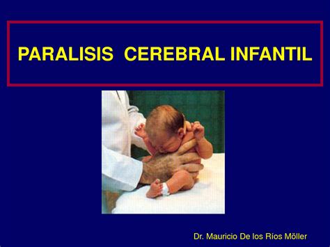 PCI Paralisis cerebral infantil tipos causas y tratamientos | Guía de la discapacidad