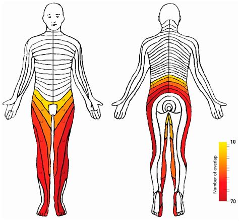 Associations between Patient Report of Pain and Intervertebral Foramina ...