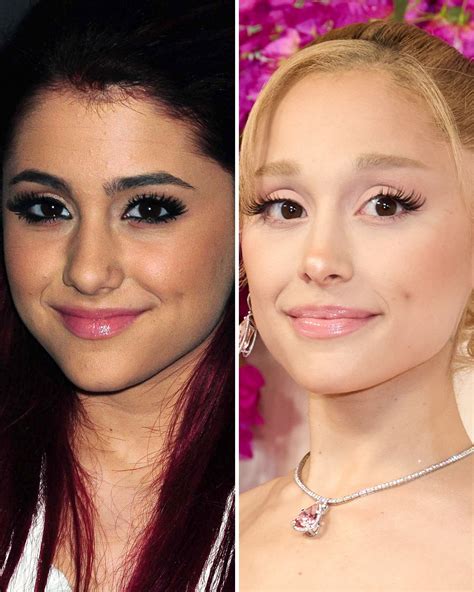 Ariana Grande, Before and After | Fuchsia lip, Plastic surgery ...